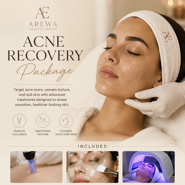 Acne Recovery Package at Arewa Essential Medspa in Mamaroneck, NY